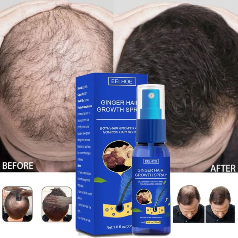 Semprotan Serum Penumbuh Rambu - Epidermal Growth Factor ulasan dan harga