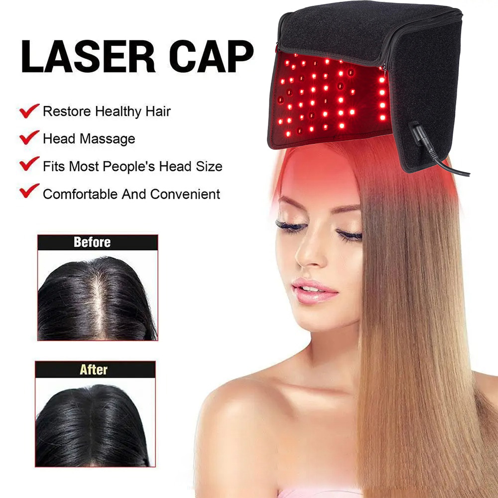 Topi Terapi Cahaya Merah 215 L - Epidermal Growth Factor ulasan dan harga