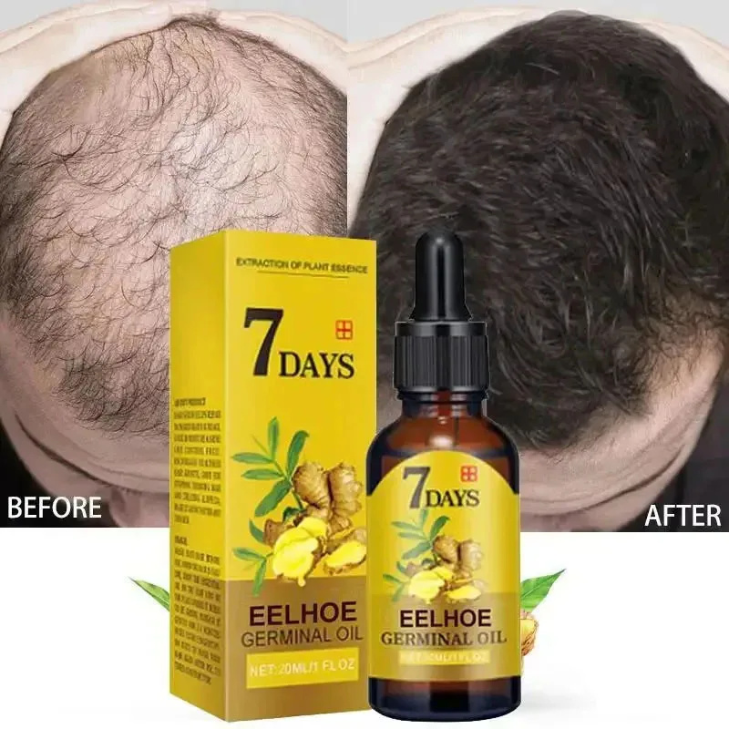 Serum Penumbuh Rambut Cepat 7  - Epidermal Growth Factor ulasan dan harga