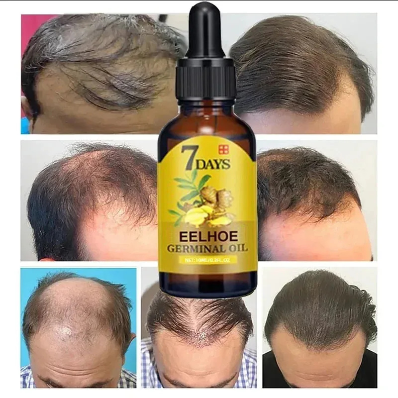 Serum Penumbuh Rambut Cepat 7  - Epidermal Growth Factor ulasan dan harga