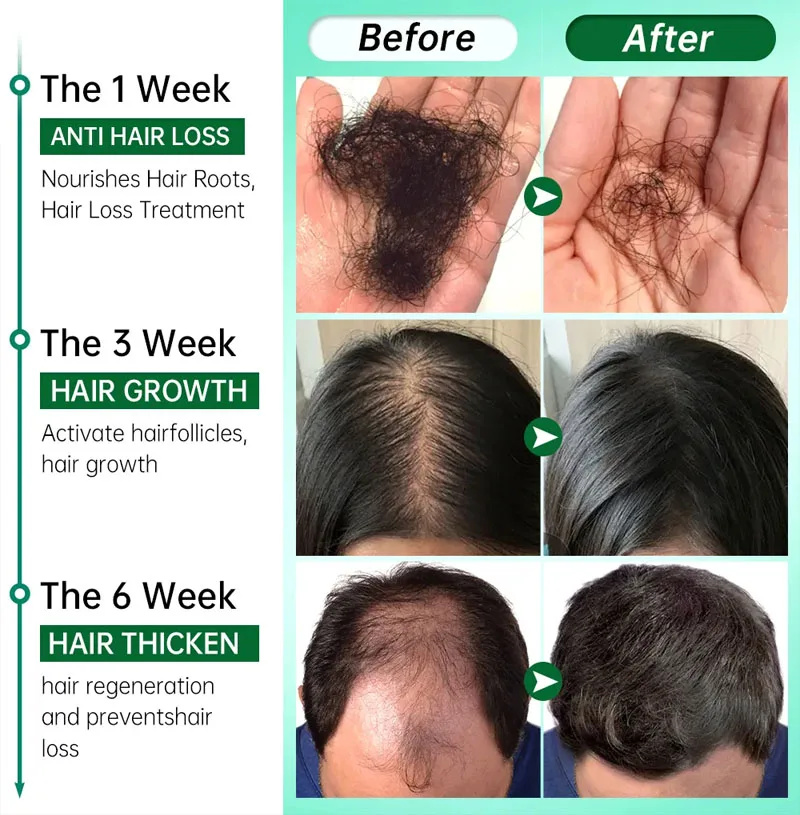 Serum Penumbuh Rambut Cepat 7  - Epidermal Growth Factor ulasan dan harga